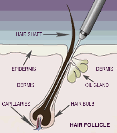 Hair Follicle